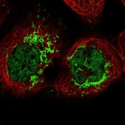 MFSD12 Antibody, Novus Biologicals 0.1mL; Unlabeled:Antibodies, Polyclonal